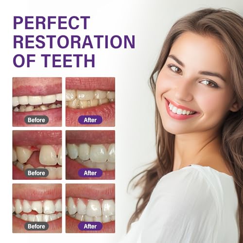 Tooth Filling Repair Kit, Temporary Tooth Filling with 5 Dental Tools, Fixing The Missing and Broken Tooth Replacements, Regain Confidence Smile - Image 6